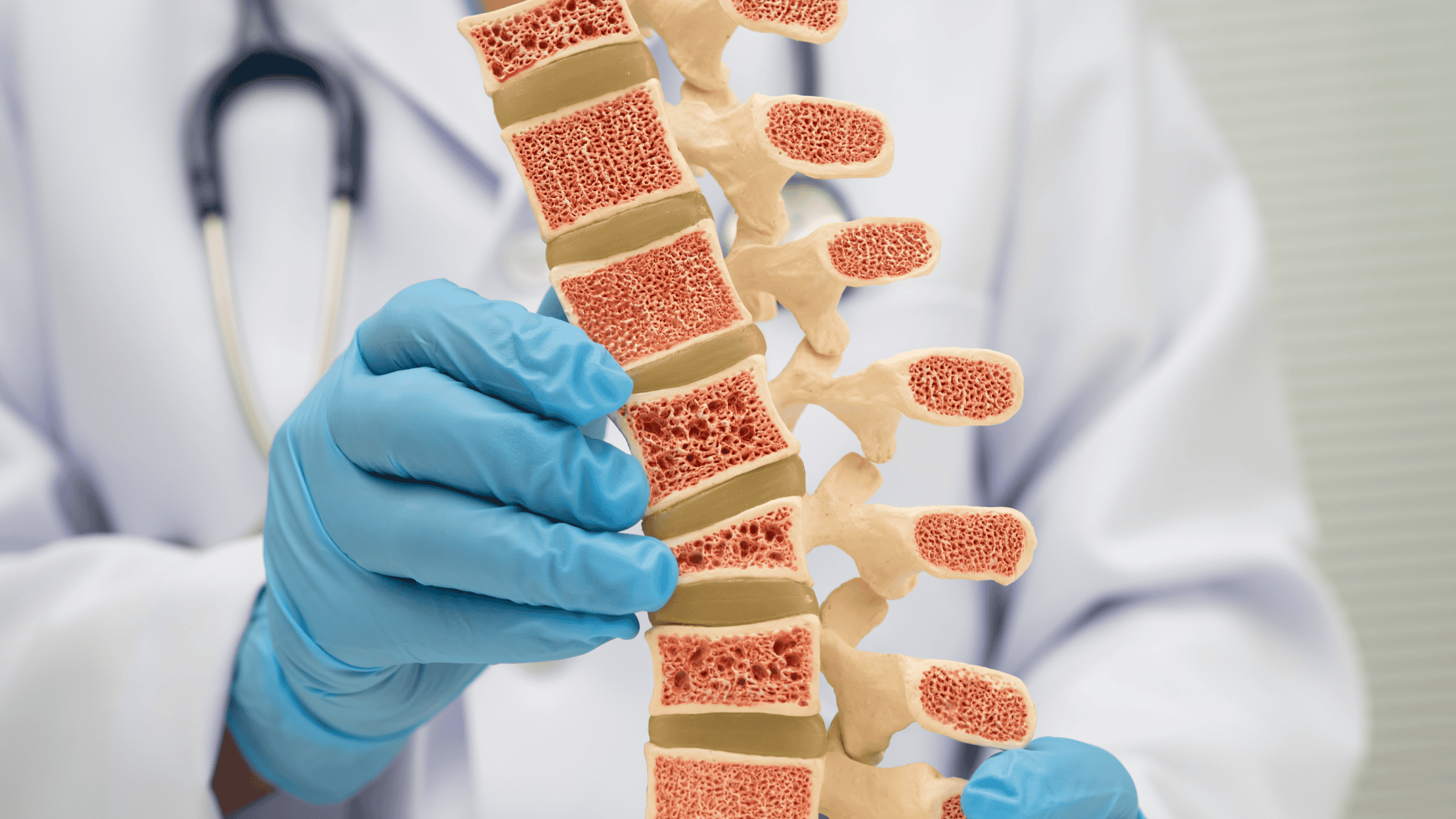 osteoporosis vs osteoarthritis